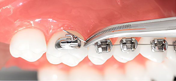 karolina kontou orthodontics