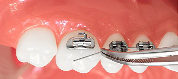 karolina kontou orthodontics