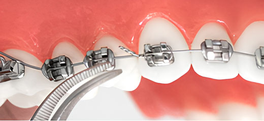 karolina kontou orthodontics