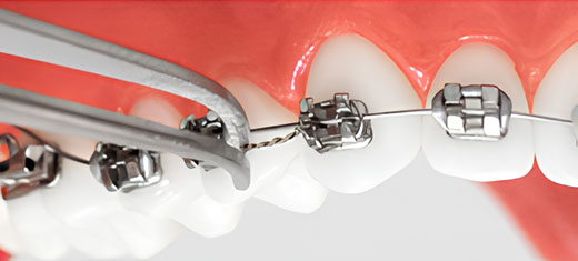 karolina kontou orthodontics
