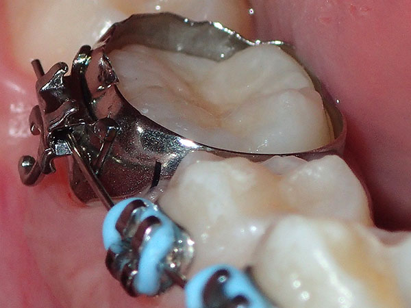 karolina kontou orthodontics